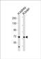 Acetoacetyl-CoA Synthetase antibody, PA5-49422, Invitrogen Antibodies, Western Blot image 