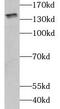 Cell Adhesion Molecule L1 Like antibody, FNab01655, FineTest, Western Blot image 
