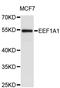 Eukaryotic Translation Elongation Factor 1 Alpha 1 antibody, abx126891, Abbexa, Western Blot image 