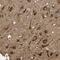 Leucine Rich Repeat And Coiled-Coil Centrosomal Protein 1 antibody, PA5-53006, Invitrogen Antibodies, Immunohistochemistry paraffin image 