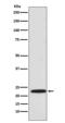 Proteasome Subunit Beta 8 antibody, M02188-2, Boster Biological Technology, Western Blot image 