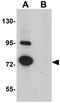 Sushi Repeat Containing Protein X-Linked antibody, GTX31394, GeneTex, Western Blot image 