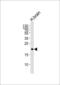 Hippocalcin antibody, MBS9203854, MyBioSource, Western Blot image 