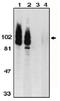 ADAM 17 antibody, AP05095PU-N, Origene, Western Blot image 