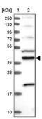 Armadillo Repeat Containing 4 antibody, PA5-58129, Invitrogen Antibodies, Western Blot image 