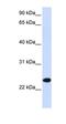 Paired Immunoglobin Like Type 2 Receptor Beta antibody, orb330499, Biorbyt, Western Blot image 