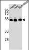 Tubulin Beta 2B Class IIb antibody, PA5-48314, Invitrogen Antibodies, Western Blot image 