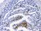 Dihydroorotate Dehydrogenase (Quinone) antibody, PB10056, Boster Biological Technology, Immunohistochemistry paraffin image 