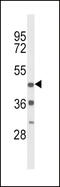 Dopamine Receptor D4 antibody, 63-631, ProSci, Western Blot image 