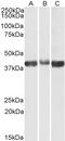 Aldolase, Fructose-Bisphosphate A antibody, TA329071, Origene, Western Blot image 