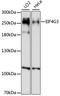 Eukaryotic Translation Initiation Factor 4 Gamma 3 antibody, LS-C749615, Lifespan Biosciences, Western Blot image 