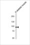 Pfk-m antibody, LS-C101264, Lifespan Biosciences, Western Blot image 