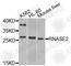 Ribonuclease A Family Member 2 antibody, A9949, ABclonal Technology, Western Blot image 