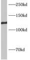 Adaptor Related Protein Complex 3 Subunit Beta 2 antibody, FNab00464, FineTest, Western Blot image 