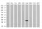 Deoxycytidine Kinase antibody, NBP2-00590, Novus Biologicals, Western Blot image 