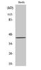 Carbohydrate Sulfotransferase 10 antibody, A10117-1, Boster Biological Technology, Western Blot image 