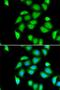 Ribosomal Protein S5 antibody, LS-C346164, Lifespan Biosciences, Immunofluorescence image 