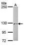 Phosphorylase b kinase regulatory subunit alpha, liver isoform antibody, orb69885, Biorbyt, Western Blot image 