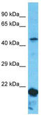 Probable aminopeptidase NPEPL1 antibody, TA337469, Origene, Western Blot image 