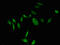 Thymidylate Synthetase antibody, orb51122, Biorbyt, Immunofluorescence image 