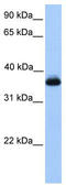 ERI1 Exoribonuclease Family Member 2 antibody, TA340240, Origene, Western Blot image 