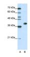 Heterogeneous Nuclear Ribonucleoprotein A3 antibody, orb324945, Biorbyt, Western Blot image 