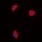 A-Kinase Anchoring Protein 1 antibody, LS-C413164, Lifespan Biosciences, Immunofluorescence image 