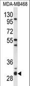 Proteasome Assembly Chaperone 2 antibody, LS-C162253, Lifespan Biosciences, Western Blot image 
