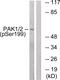 Alpha-PAK antibody, 79-818, ProSci, Western Blot image 