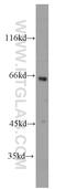 SH2 domain-containing protein 3A antibody, 15641-1-AP, Proteintech Group, Western Blot image 