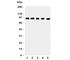 Colorectal mutant cancer protein antibody, R31425, NSJ Bioreagents, Western Blot image 