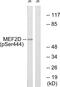 Myocyte Enhancer Factor 2D antibody, PA5-38293, Invitrogen Antibodies, Western Blot image 