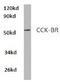 Cholecystokinin B Receptor antibody, AP01421PU-N, Origene, Western Blot image 