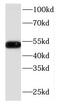 Keratin 14 antibody, FNab02196, FineTest, Western Blot image 