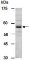 Protein Inhibitor Of Activated STAT 1 antibody, orb67013, Biorbyt, Western Blot image 
