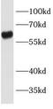 Lipopolysaccharide-binding protein antibody, FNab04714, FineTest, Western Blot image 