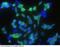 CRABP-II antibody, 11203-R004, Sino Biological, Immunohistochemistry frozen image 
