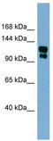 Transient Receptor Potential Cation Channel Subfamily A Member 1 antibody, TA338564, Origene, Western Blot image 