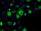 Protein Phosphatase 5 Catalytic Subunit antibody, LS-C114689, Lifespan Biosciences, Immunofluorescence image 
