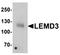LEM Domain Containing 3 antibody, orb75695, Biorbyt, Western Blot image 