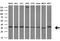 Retinoic Acid Receptor Responder 1 antibody, NBP2-45517, Novus Biologicals, Western Blot image 