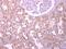 Podocalyxin Like antibody, GTX104764, GeneTex, Immunohistochemistry paraffin image 