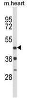 D(4) dopamine receptor antibody, AP17995PU-N, Origene, Western Blot image 