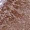 Suppressor of tumorigenicity 7 protein antibody, NBP1-84772, Novus Biologicals, Immunohistochemistry paraffin image 