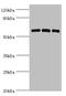Protein Kinase AMP-Activated Catalytic Subunit Alpha 2 antibody, orb353087, Biorbyt, Western Blot image 