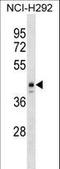Homeobox protein ESX1 antibody, LS-C159573, Lifespan Biosciences, Western Blot image 