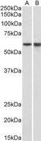 TATA-Box Binding Protein antibody, 42-998, ProSci, Immunofluorescence image 