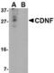 Cerebral Dopamine Neurotrophic Factor antibody, TA306477, Origene, Western Blot image 