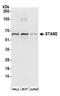 Signal Transducing Adaptor Molecule 2 antibody, A304-818A, Bethyl Labs, Western Blot image 