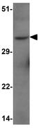 Forkhead Box H1 antibody, GTX17182, GeneTex, Western Blot image 